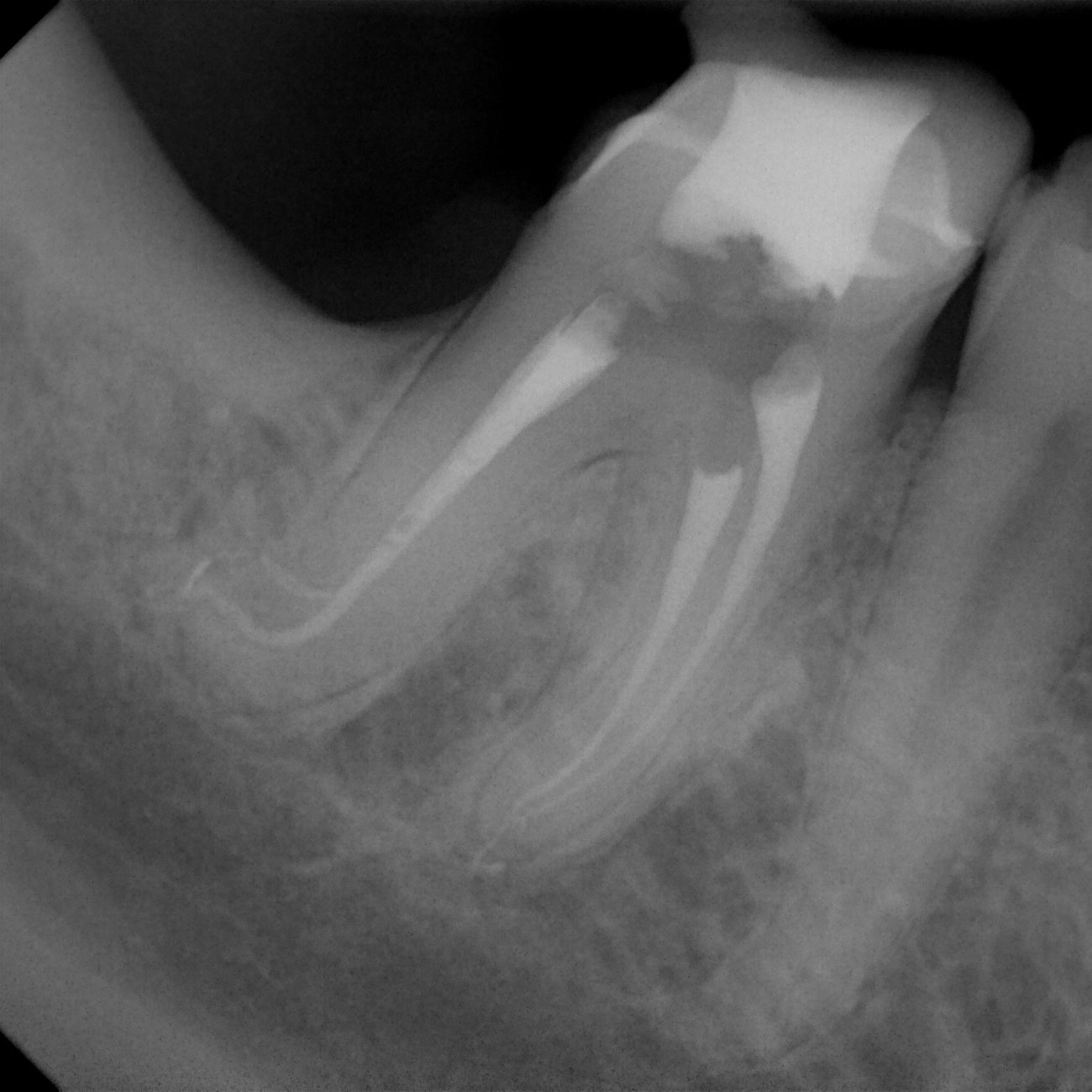 Digital Radiography Digital Radiography